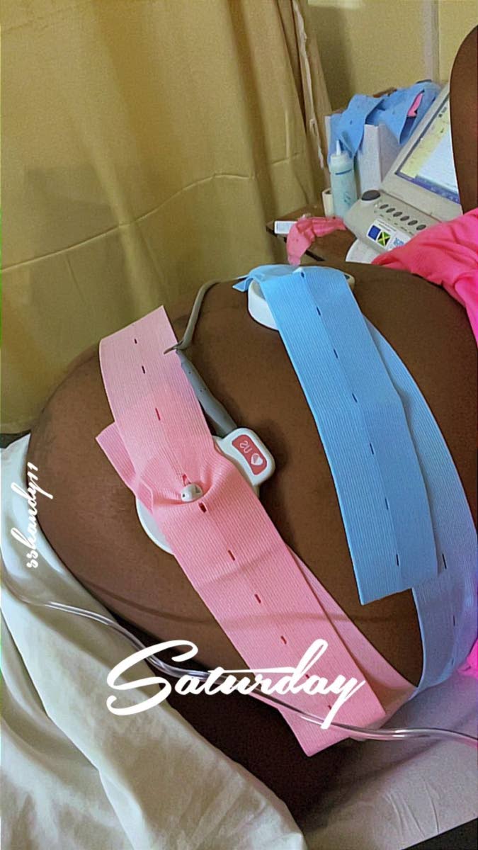 Monitoring devices connected to Shandale Ballentine during her recent stay at the Cornwall Regional Hospital to give birth. 