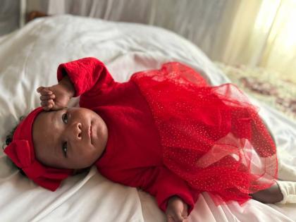 Anna-Olivia Gardener, who has been diagnosed with Patau syndrome, or Trisomy 13.